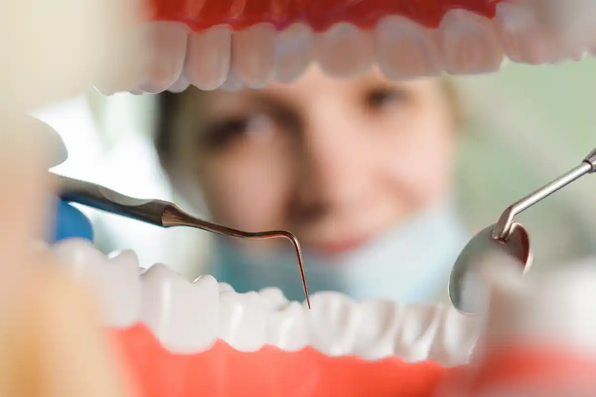 parodontologija banja luka liječenje desni