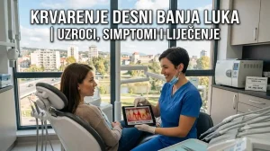 krvarenje desni banja luka