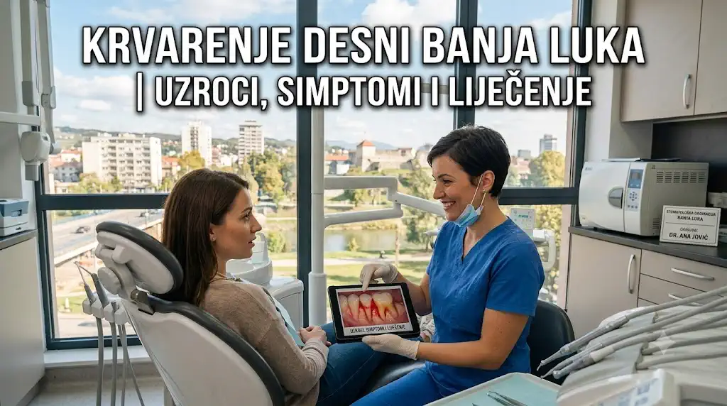 krvarenje desni banja luka