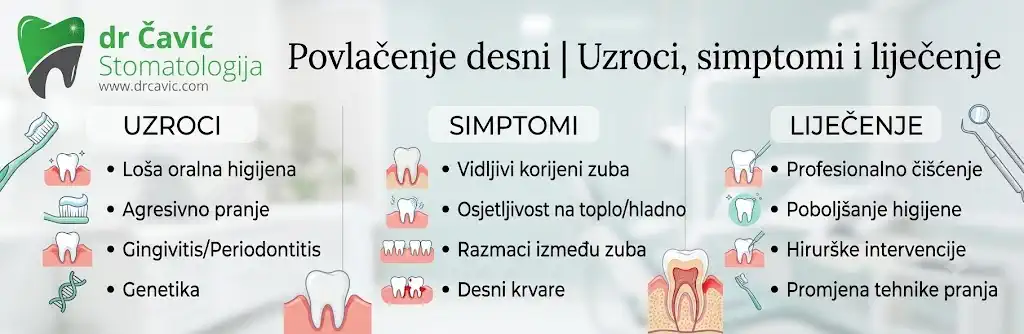 povlačenje desni banja luka